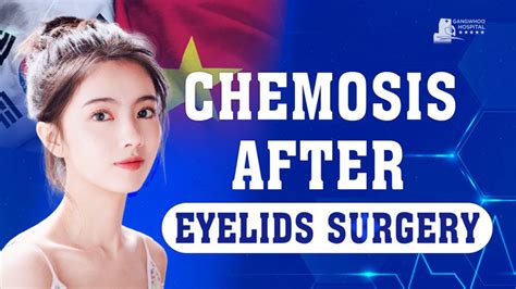 Chemosis Information .